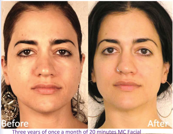 TAMA Microcurrent Facial - Postiche